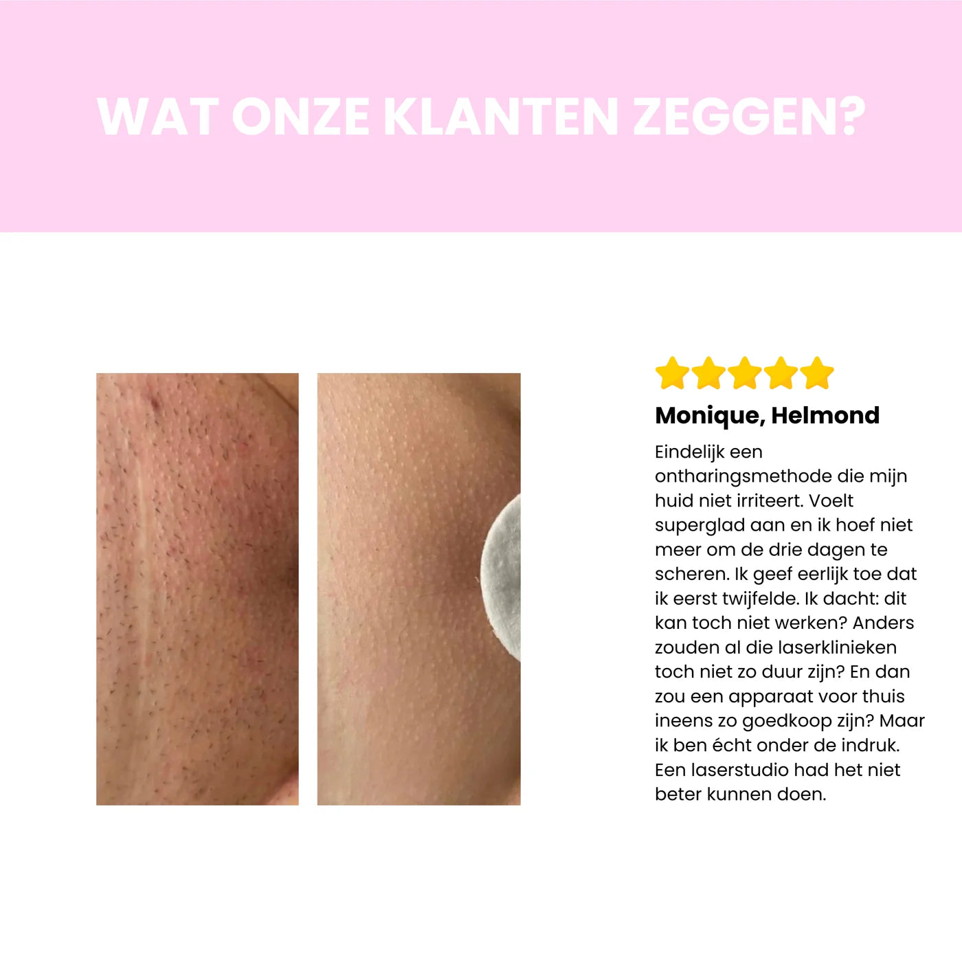 Sidea IPL Haarverwijderaar – Professionele laserontharing voor thuisgebruik