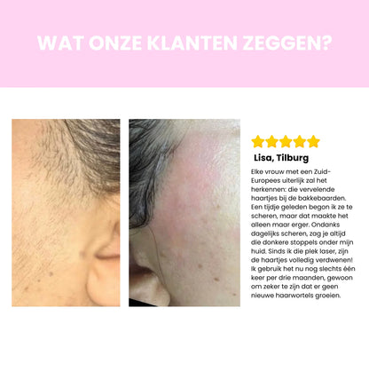 Sidea IPL Haarverwijderaar – Professionele laserontharing voor thuisgebruik
